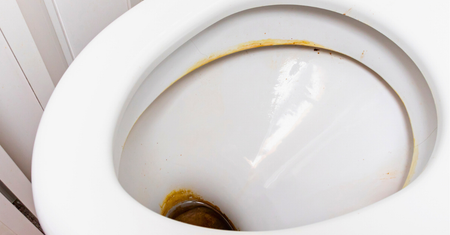 Wrzuć do WC. Kamień zniknie po 15 minutach