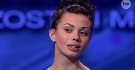 "Top Model": dziewczyna z blizną poruszyła jurorów! Dostała się do programu?