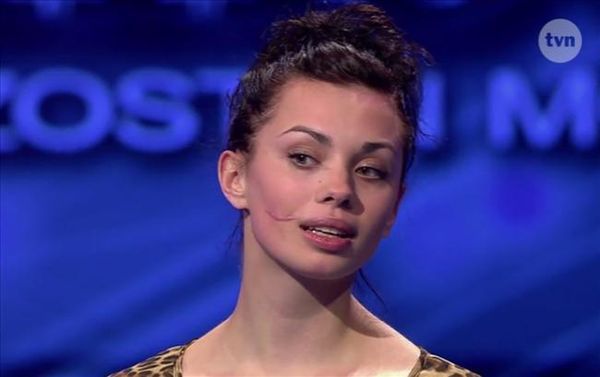 "Top Model": dziewczyna z blizną poruszyła jurorów! Dostała się do programu?