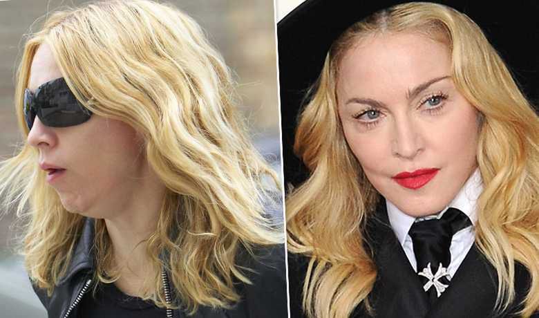 Madonna - przed i po liftingu