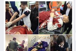 Szpital i obryzgana krwią koszula. Tak wyglądają "egzotyczne wakacje" rezydentów