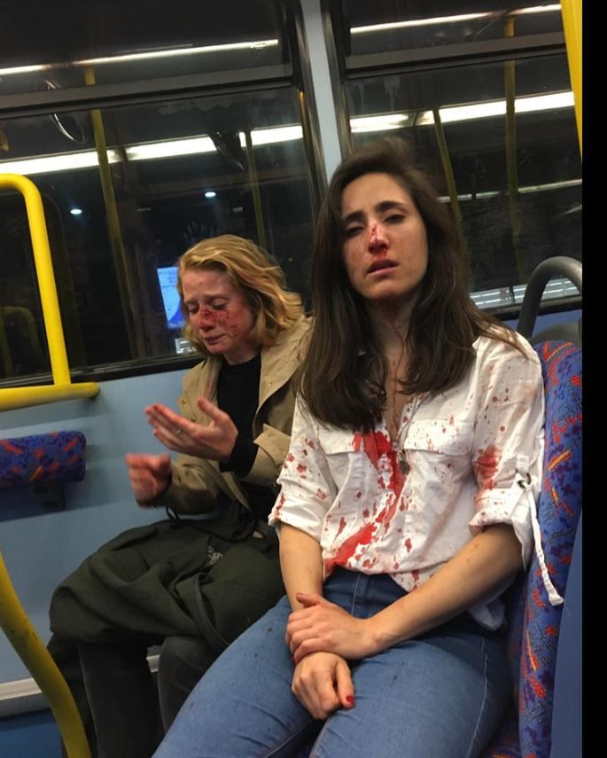Londyn. Dwie napadnięte kobiety w autobusie