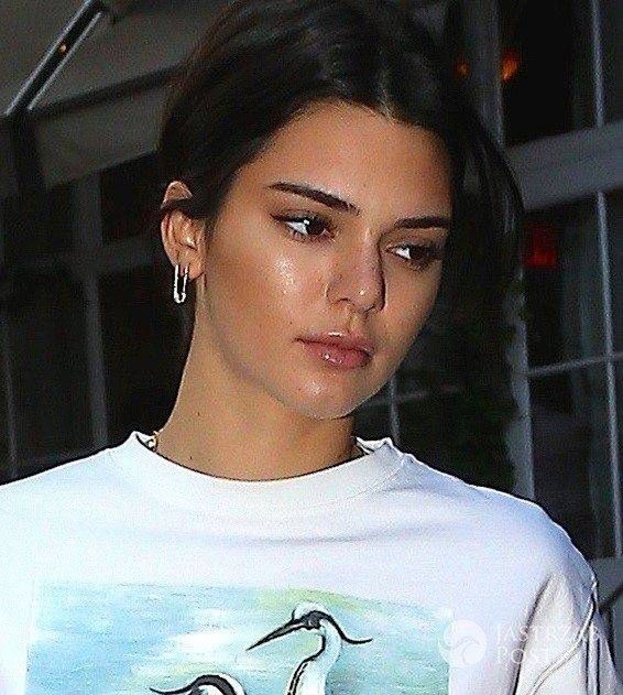 Większe usta Kendall Jenner