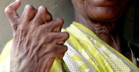 Mówią, że jest czarownicą. Ma 31 palców i nie wychodzi z domu