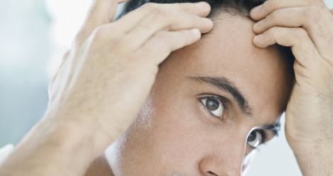 Pięć mitów o męskim łysieniu
