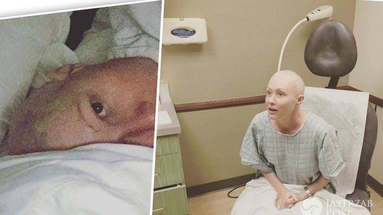 Shannen Doherty po chemioterapii