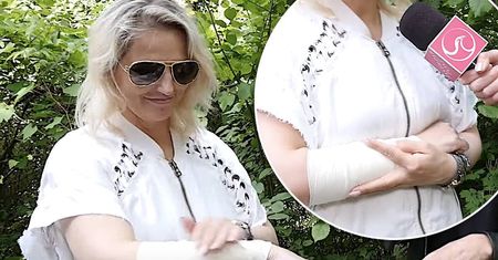 Dominika Tajner ze sporym bandażem na ręce. Za nią seria bolesnych zabiegów. Zdradziła nam szczegóły