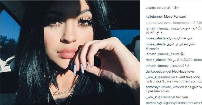 Kylie Jenner ma kompleks ust