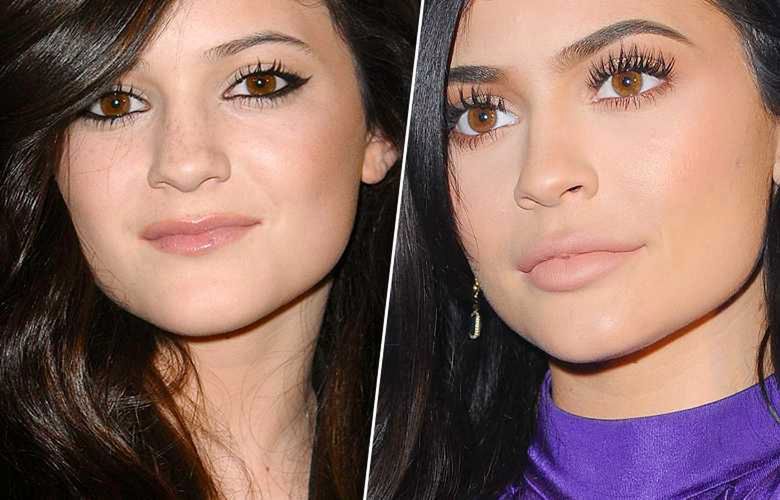 Kylie Jenner – nos