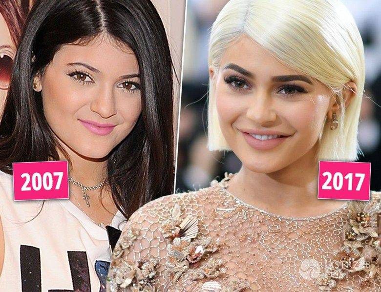Kylie Jenner - kiedyś i dzisiaj, metamorfoza