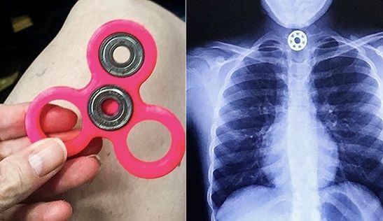 Fidget spinner