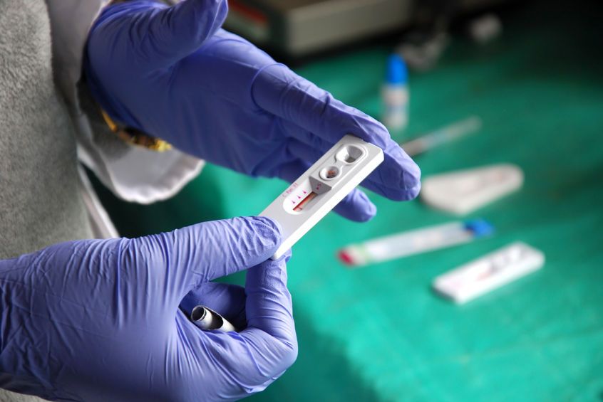 Powstanie szczepionka na HIV. Już niedługo pierwsze testy