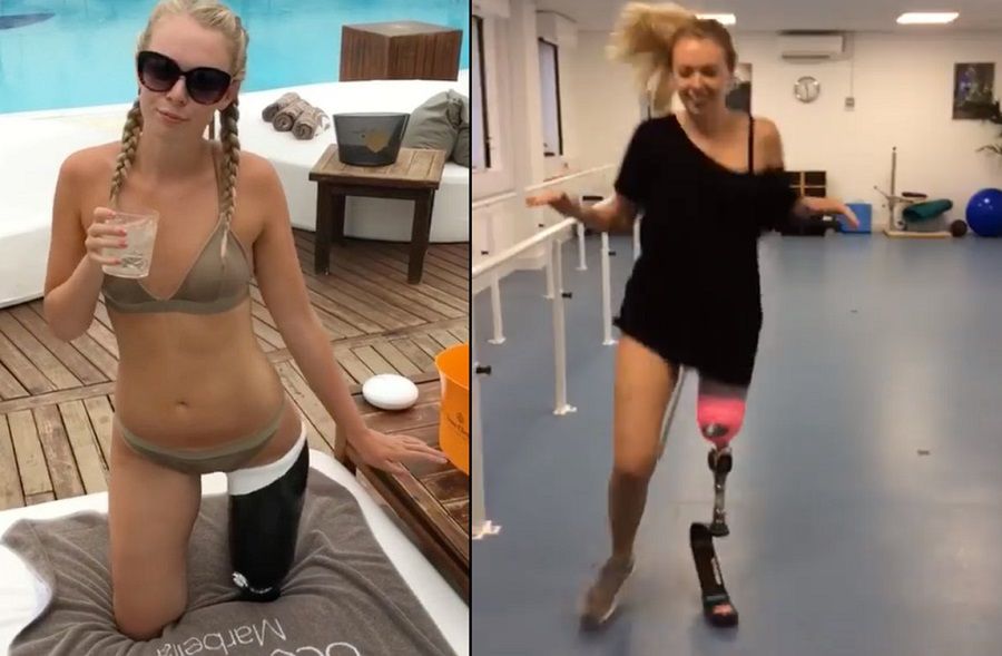 W 2015 roku straciła nogę. Po trzech latach 20-latka znowu może biegać