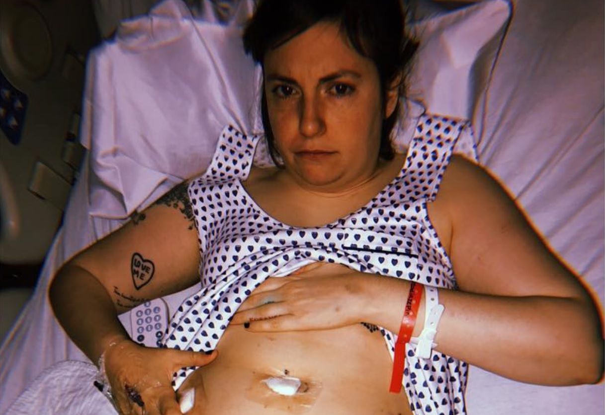 Lena Dunham pokazała zdjęcie po poważnej operacji. "Majtki z siatki i blizny są super"