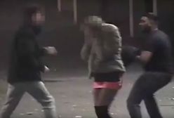 Złamali jej nos i ciężko pobili. Rasistowski atak w Anglii i zaskakujące zachowanie sprawcy