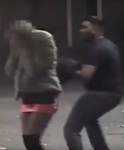 Złamali jej nos i ciężko pobili. Rasistowski atak w Anglii i zaskakujące zachowanie sprawcy