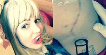 Agnieszka Orzechowska: Wyję z bólu! Skóra śmierdzi spalenizną