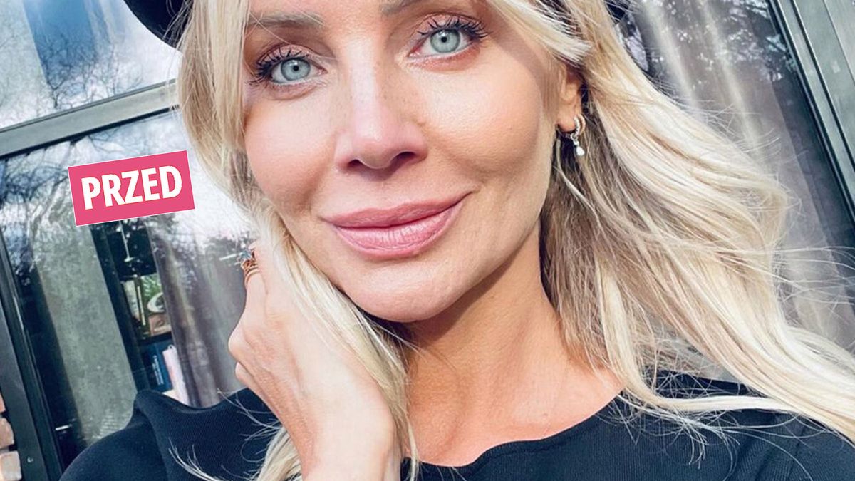 Agnieszka Woźniak-Starak