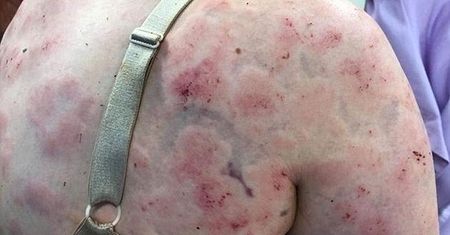Matka ratowała dziecko przed tornadem. Tak teraz wygląda jej ciało