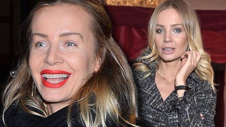 Agnieszka Woźniak-Starak w aparacie ortodontycznym