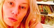 Monika Jarosińska pierwszy raz po operacji. Widać, że przeszła skomplikowany zabieg?