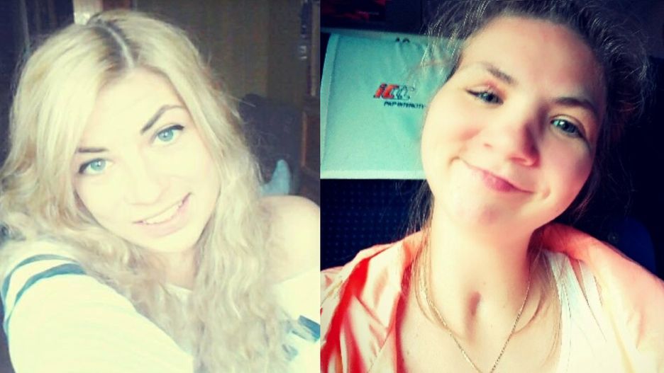 Ala przed i po wypadku - zgoda na wykorzystanie zdjęć tylko dla Wirtualnej Polski