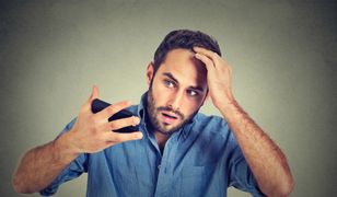 Wypadanie włosów – przyczyny i sposoby leczenia