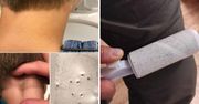 Nowy sposób na kleszcze leśników! Tani i skuteczny trik uratuje Cię przed pogryzieniem