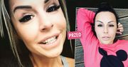 Blanka Lipińska ma nowe, śliczne ząbki. Teraz o tytuł najpiękniejszego uśmiechu może rywalizować z Piaskiem i Ibiszem