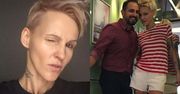 Agnieszka Chylińska chudnie w oczach! Fani są zaniepokojeni