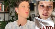 Aleksandra Domańska opowiedziała o chorobie: "Myślałam, że muszę cierpieć". Diagnoza była wybawieniem
