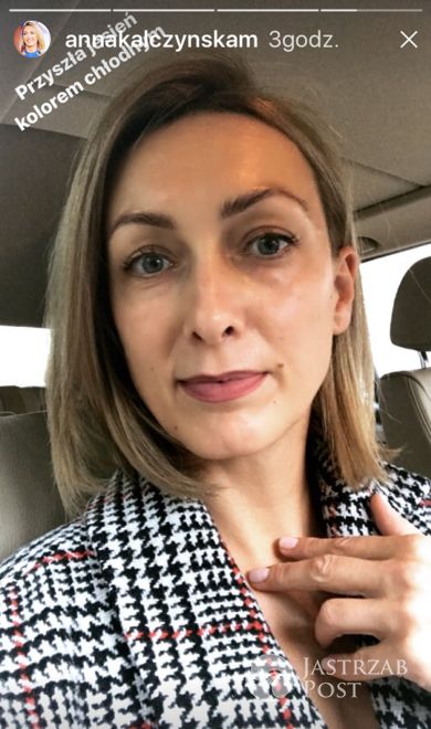 Anna Kalczyńska bez makijażu