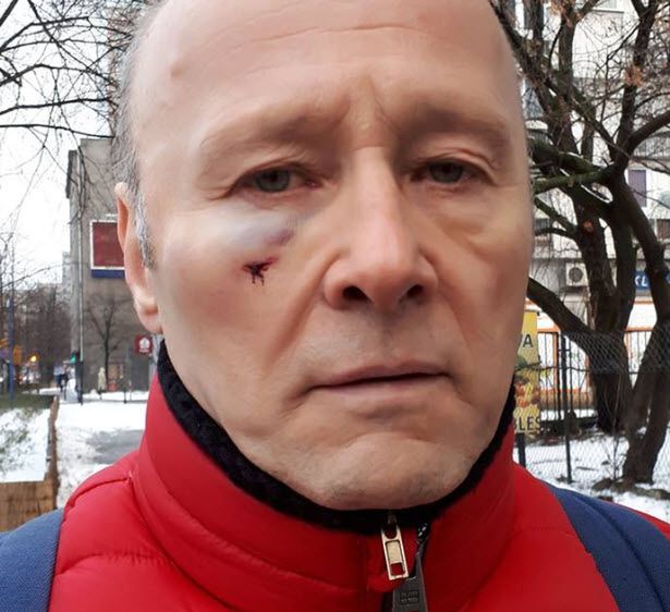 Mocny komentarz o ataku na Pieczyńskiego: "Był wyzywany od pedałów i pobity za zwykłą, czerwoną kurtkę!"