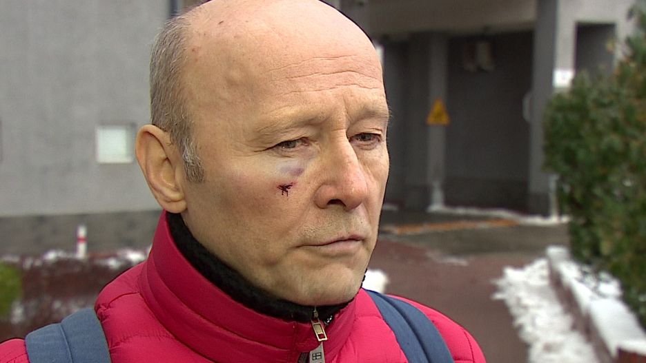 Aktor tłumaczy, że próbował się bronić