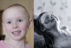 "Żadne dziecko nie powinno tak cierpieć". Wstrząsające zdjęcie pokazuje piekło nowotworu 4-latki