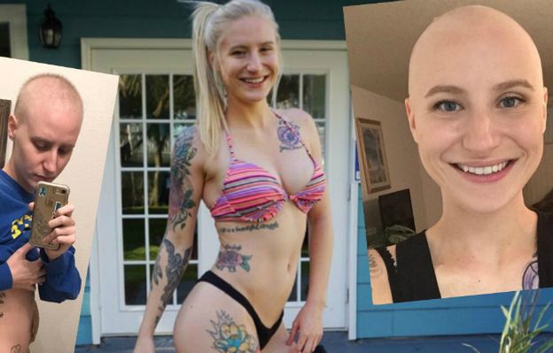 23-letnia modelka zmienia się nie do poznania. Walcząca z rakiem dziewczyna pokazała, jak choroba wyniszcza organizm