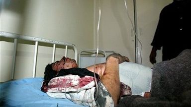 Jeden z rannych w zamachu