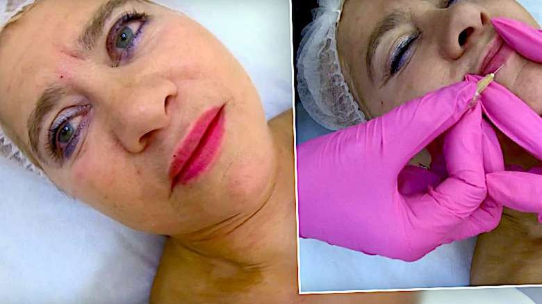 Izabela Kisio-Skorupa poprawiła twarz