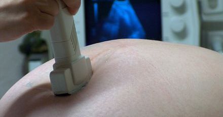 Nowy test może zwiększyć szanse powodzenia in vitro