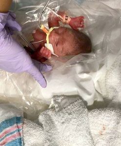 Wcześniaki bez szans na leki. Tak zadecydowało ministerstwo