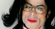 Michael Jackson: ciało króla popu przeraziło detektywa. "Łysa głowa i blizny"