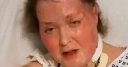Do jej domu wrzucono bomby. Zmarła po miesiącach walki o zdrowie