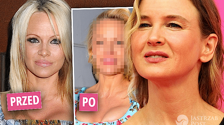 Pamela Anderson twarz