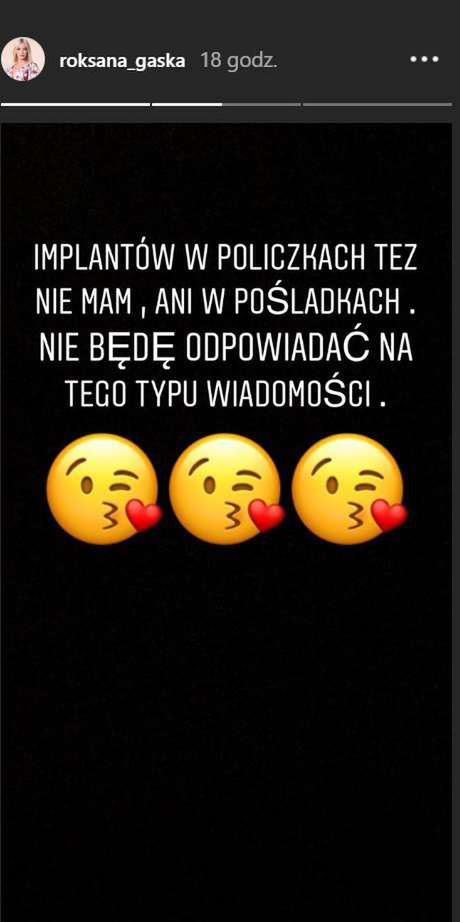 Roxi Gąska na temat operacji plastycznych