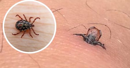 3 bezpieczne metody usuwania kleszcza bez użycia pęsety. Sprawdzą się w każdych warunkach
