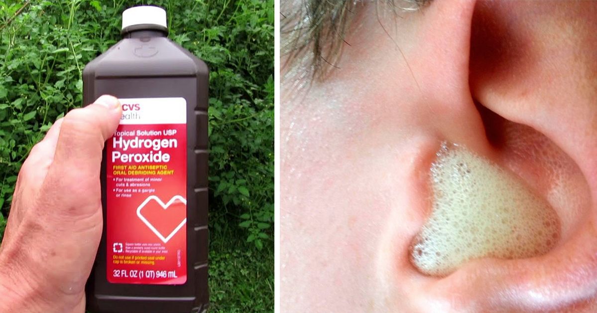 20 Surprising Uses For Hydrogen Peroxide