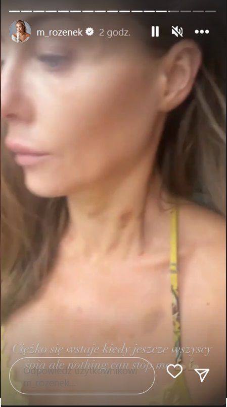 Małgorzata Rozenek
