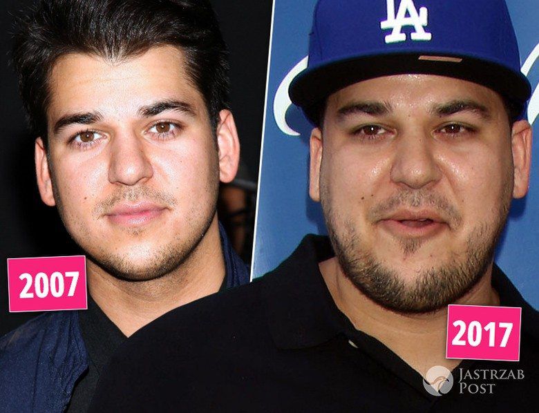 Rob Kardashian - kiedyś i dzisiaj, metamorfoza