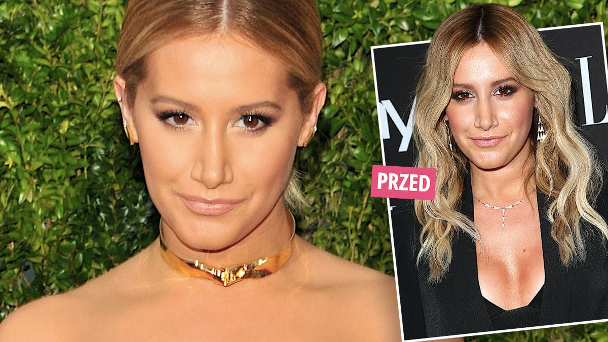 Ashley Tisdale pokazała zdjęcie po usunięciu implantów piersi. Szybko pożałowała operacji plastycznej