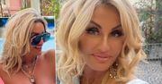Dagmara Kaźmierska pierwszy raz pokazała się w bikini. Gołym okiem widać efekty po odsysaniu tłuszczu.  „Modelka!”